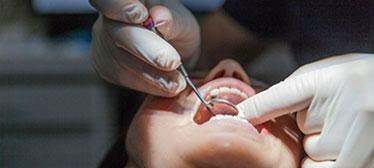 Person getting a dental exam